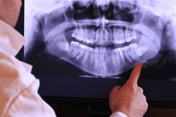 Best Cosmetic Emergency Dentistry in Piedmont, SC