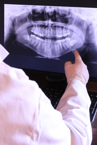 Best Emergency Dental Care for Broken or Chipped Teeth in Piedmont, SC